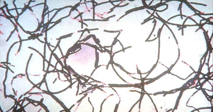 Anthrax outbreak kills more than 50 animals, infects 12 people in Zambia
