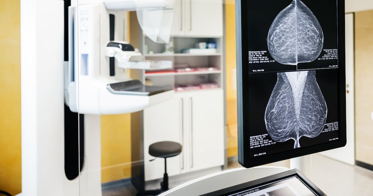 Cancer survival rates in Ireland improve ‘substantially’