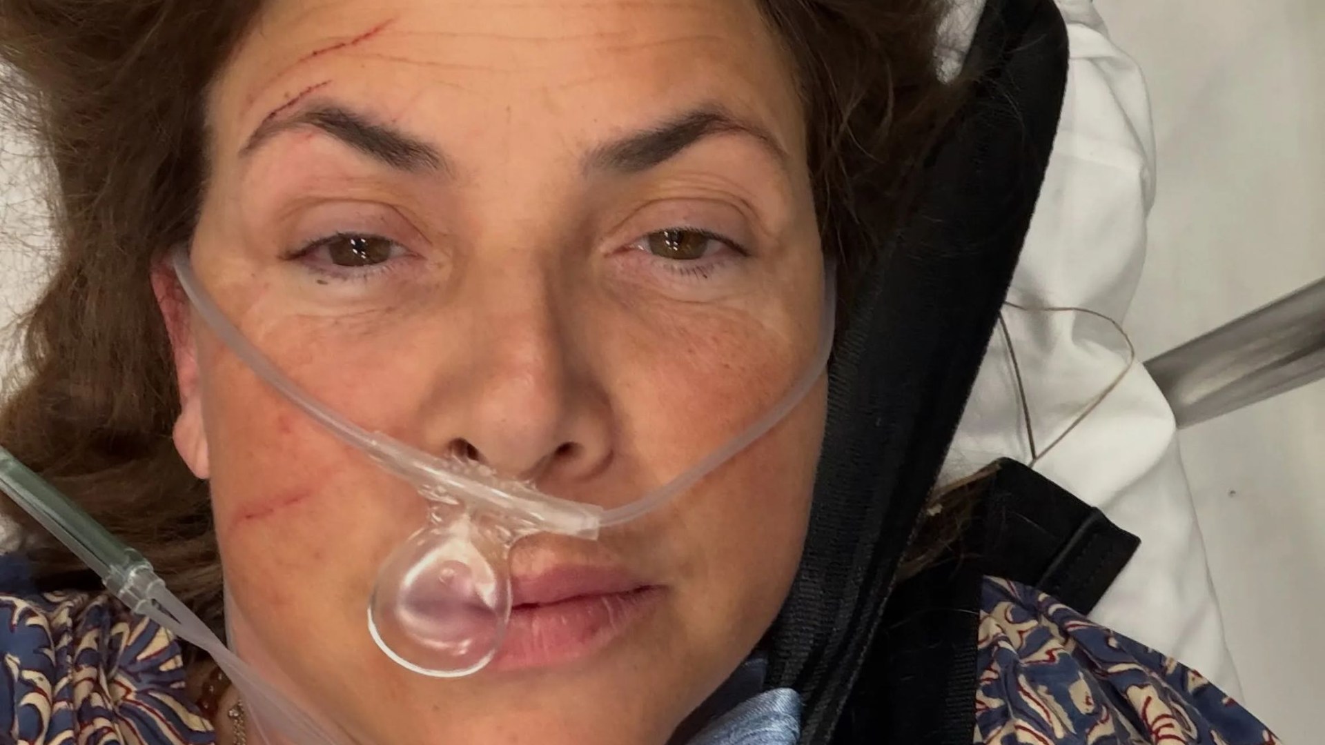 Channel 4 star Kirstie Allsopp rushed to hospital in an air ambulance after horror fall & shares snaps of bandaged foot