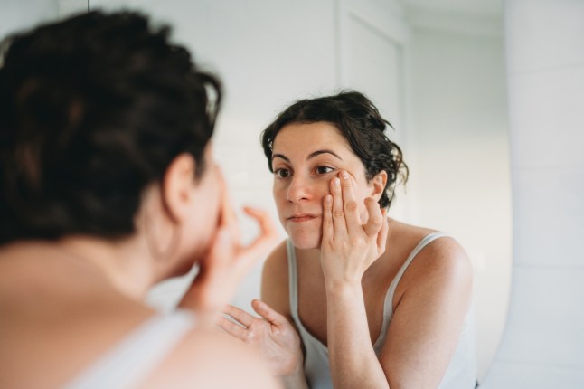 Do you have ‘ferritin face’? 9 warning signs you’re low on iron