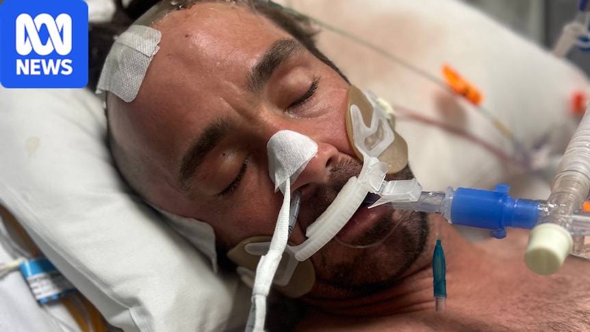 Former Olympic coach left with ongoing damage after 36-hour hospital ordeal