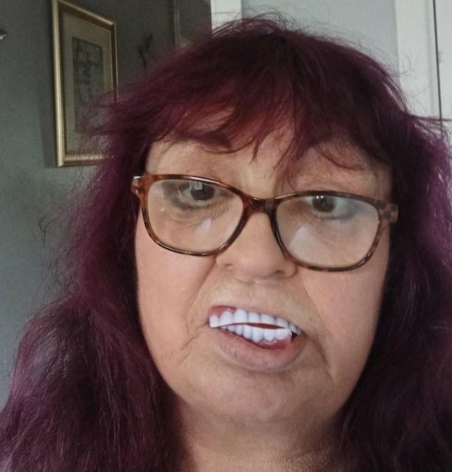 Gran says her teeth ‘look like Haribos’ after buying dentures on Facebook
