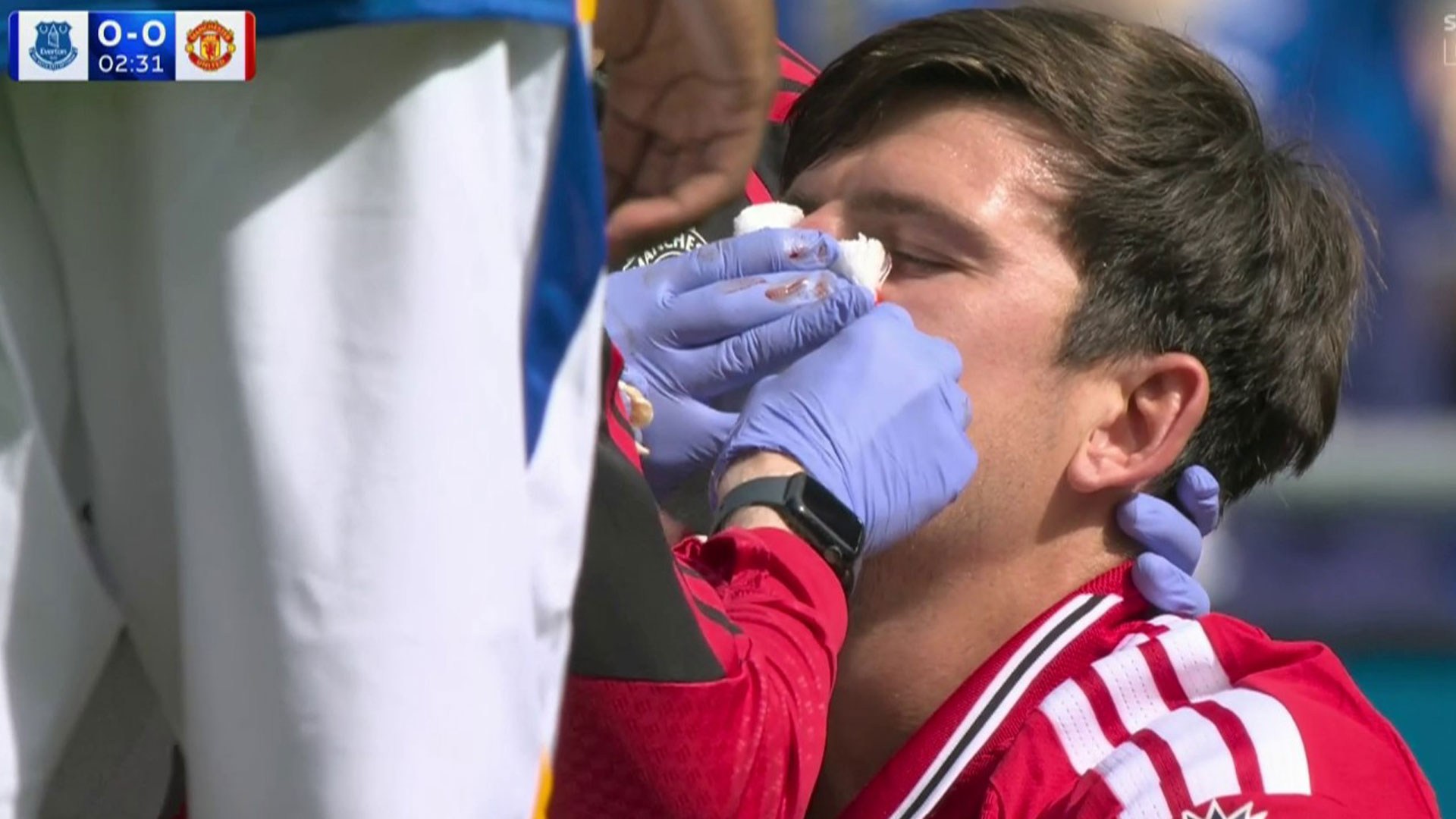 Harry Maguire left covered in blood after horror collision just seconds into Man Utd’s clash at Everton