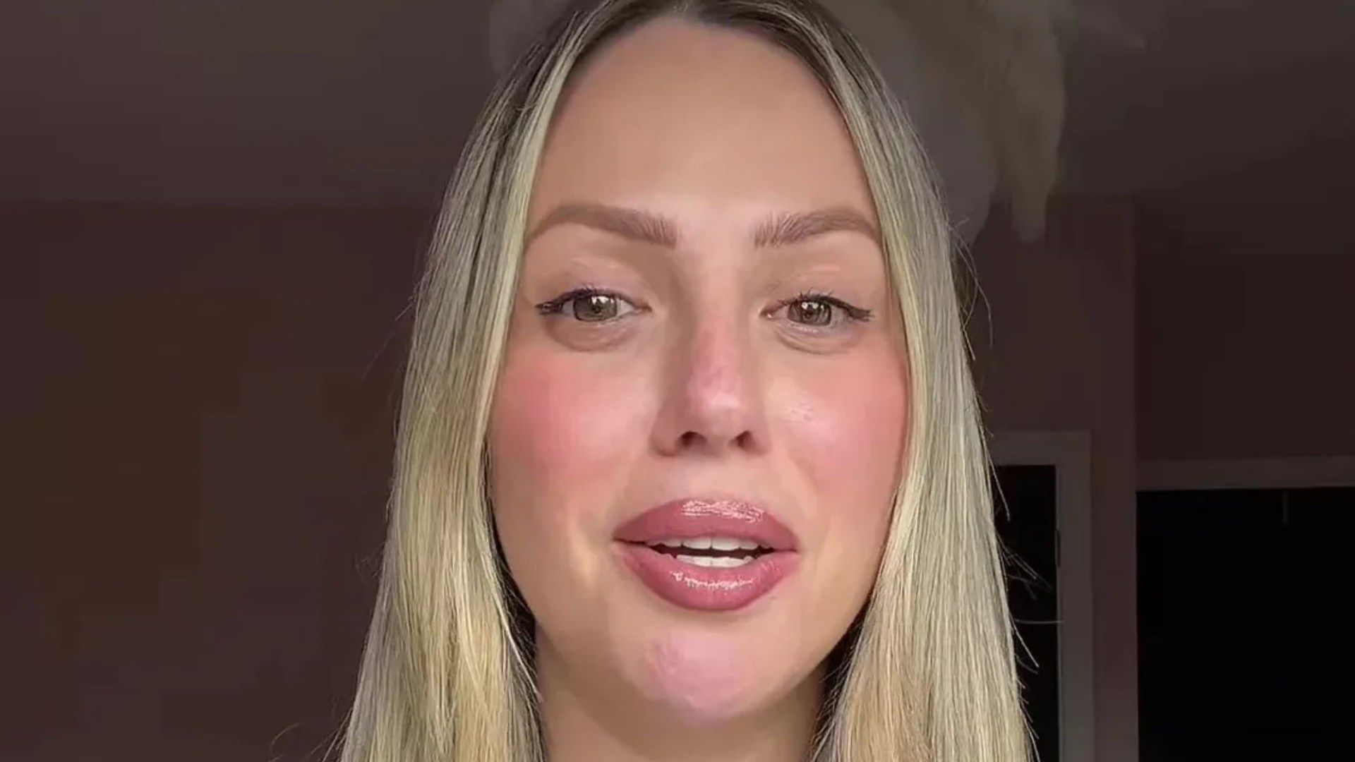 Holly Hagan describes herself as a ‘deflated water balloon’ as she reveals regret over past BBL surgeries