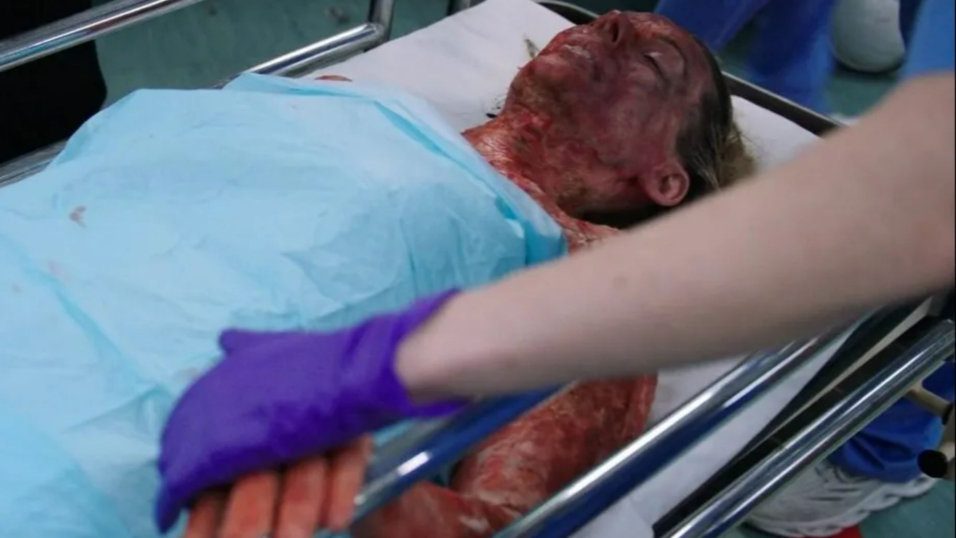 Horrifying moment EastEnders legend is burnt to a crisp in Casualty’s explosive 40th anniversary episode