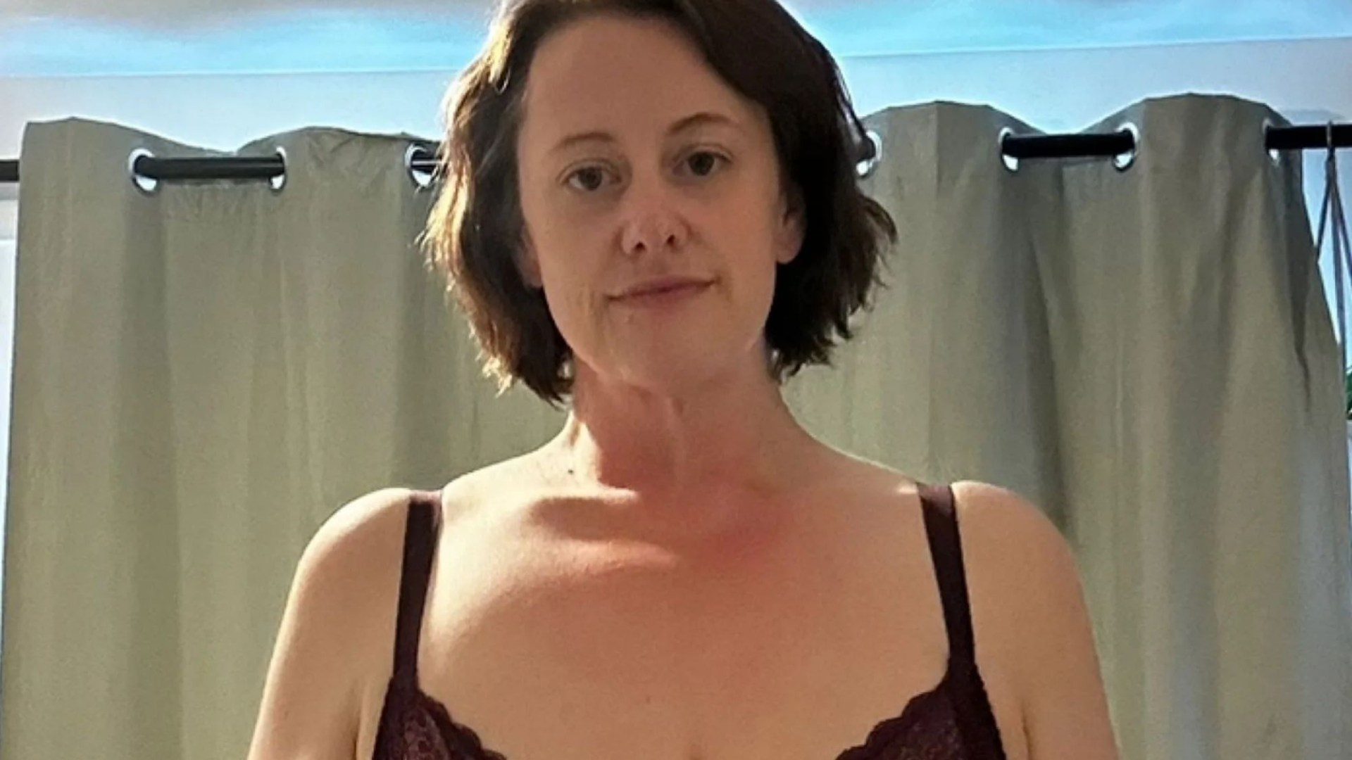 I lost 12st and am my ideal weight but I can’t feel sexy because loose skin has left me looking like a naked mole rat 
