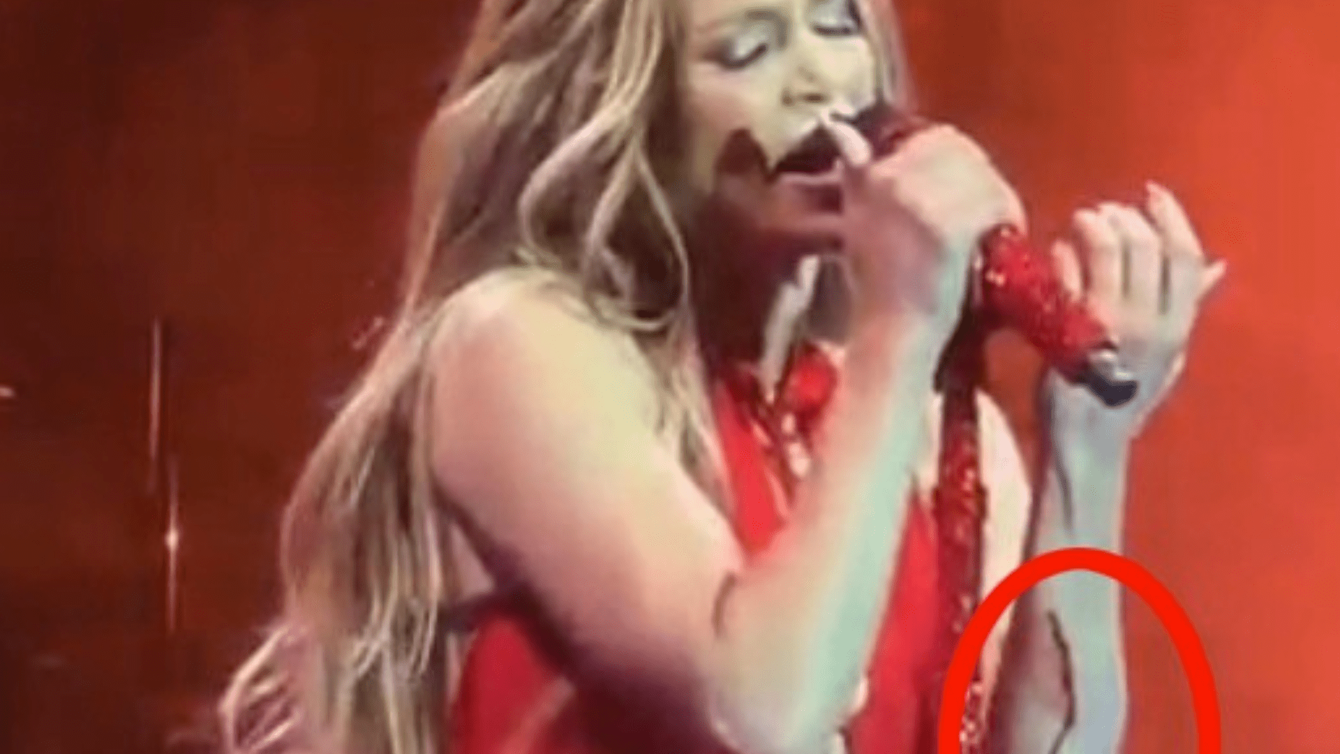 Jennifer Lopez suffers gory arm wound during live gig as blood pours from her arm