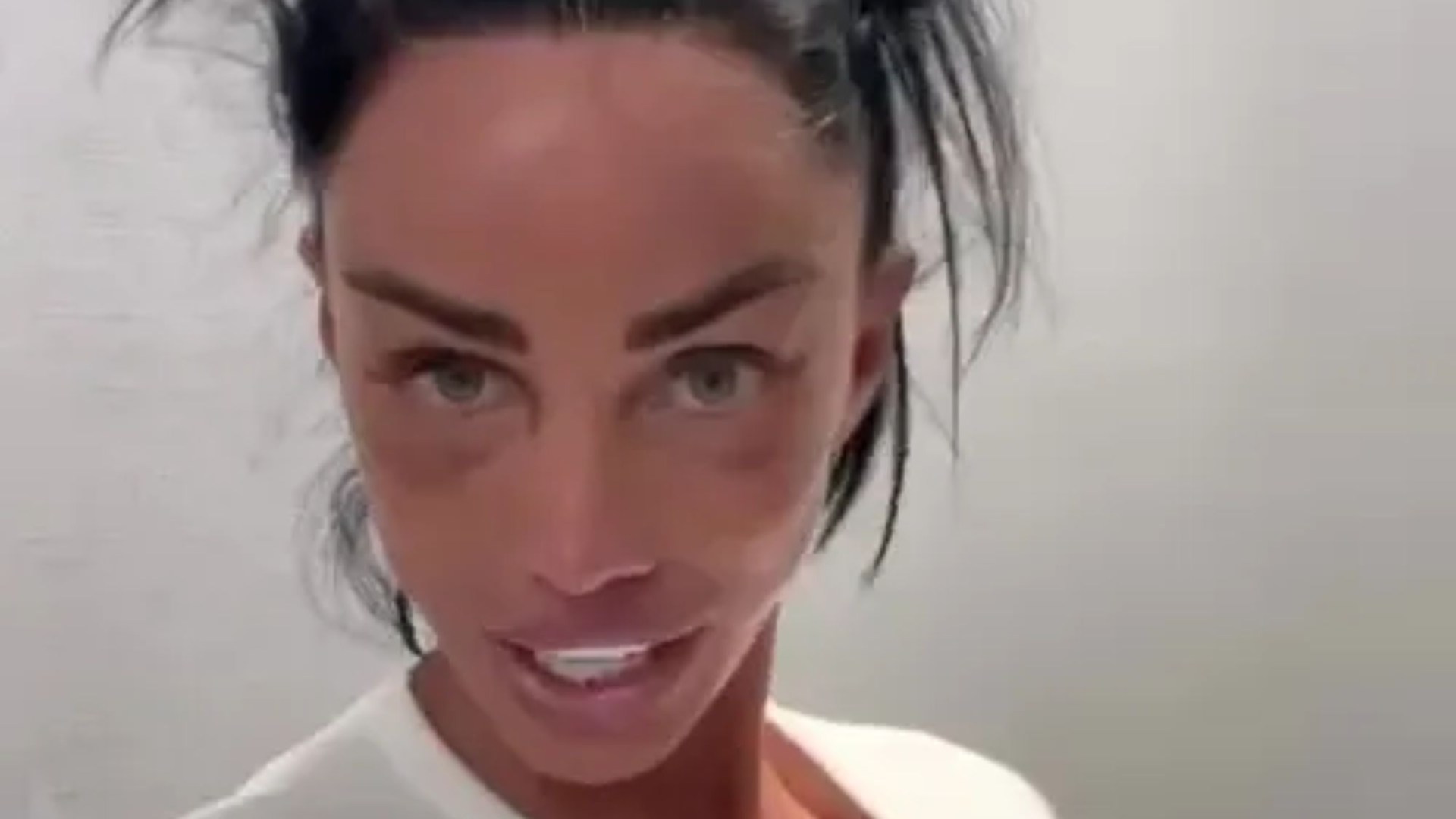 Katie Price shows off result of ‘biggest ever’ boob job after split from Lee Andrews