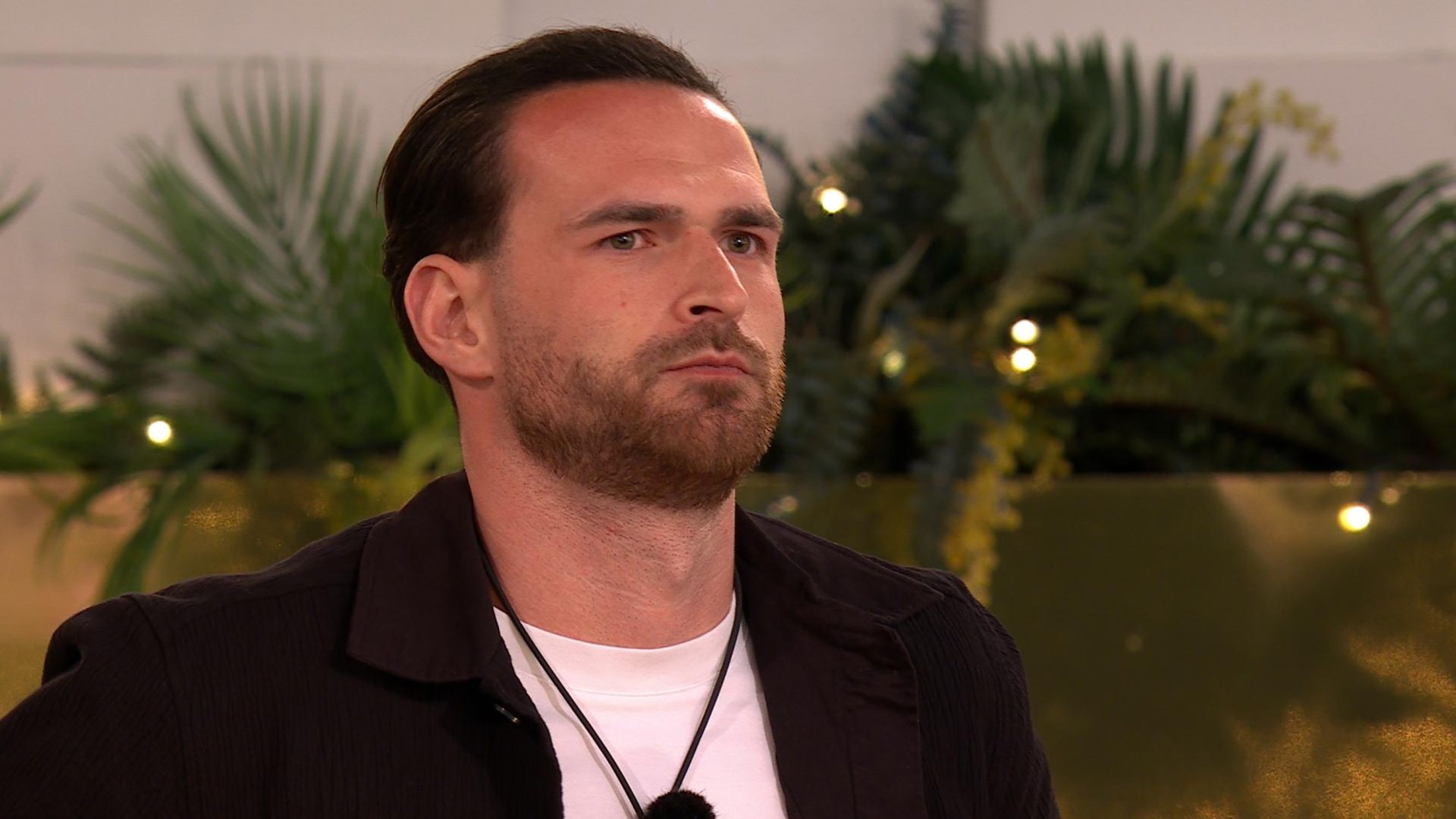 Love Island’s Ronnie Vint reveals results three months after getting hair transplant