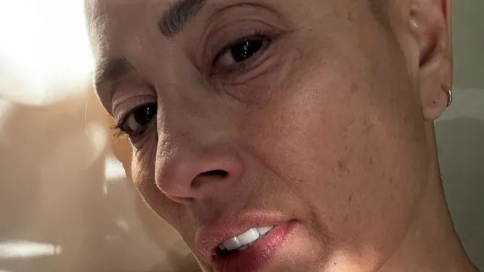 Melanie Sykes goes make-up free as she shares pictures of her shaven head after losing hair in alopecia battle