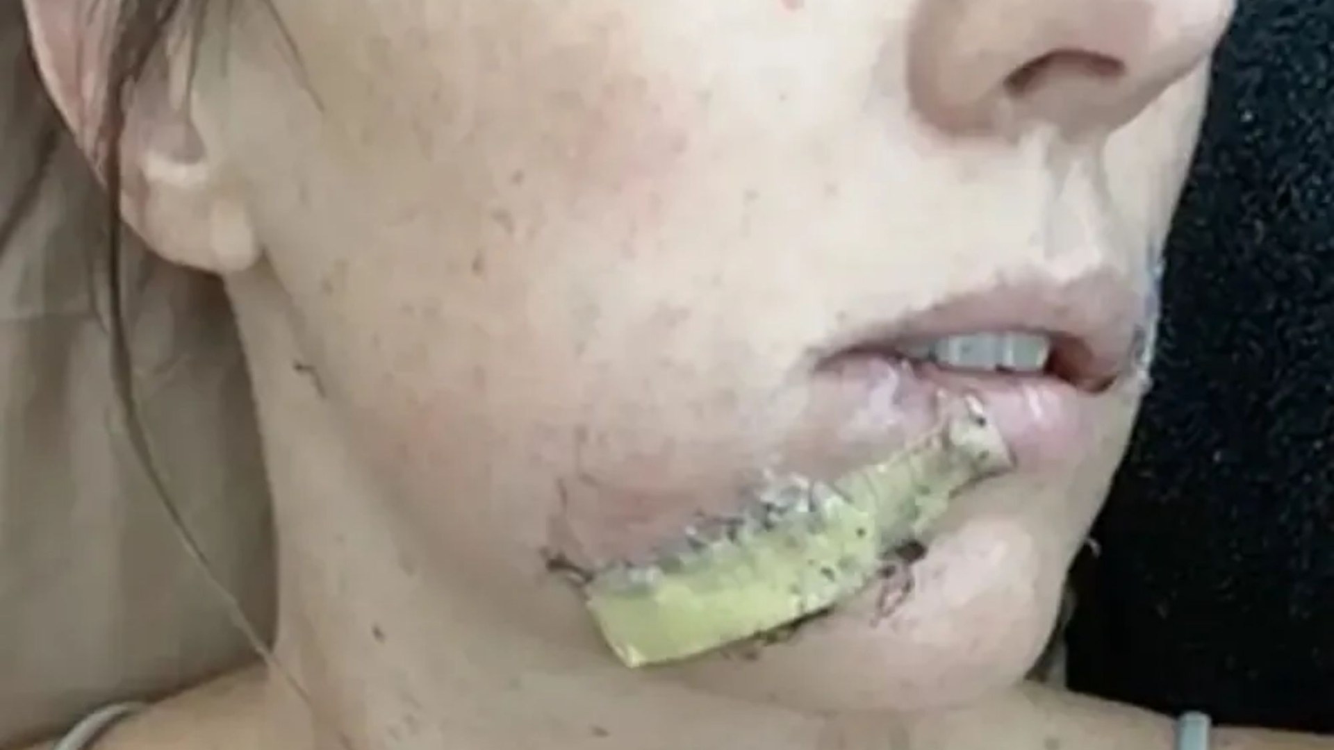 Mum fights off vicious coyote with a flip-flop after it attacks four-year-old daughter then bites her face