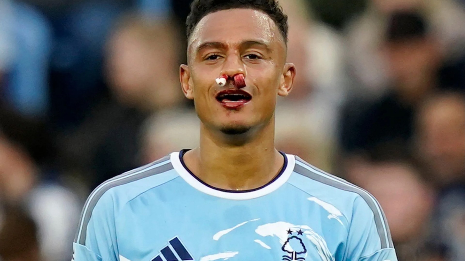 Nottingham Forest star Dan Ndoye left with blood pouring from his nose after accident during Aston Villa clash