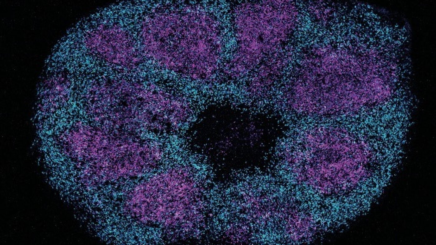 Scientists map key protein interactions linked with profound autism
