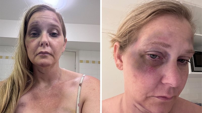 These photographs of Virginia Giuffre tell a story about what happened to her, expert says