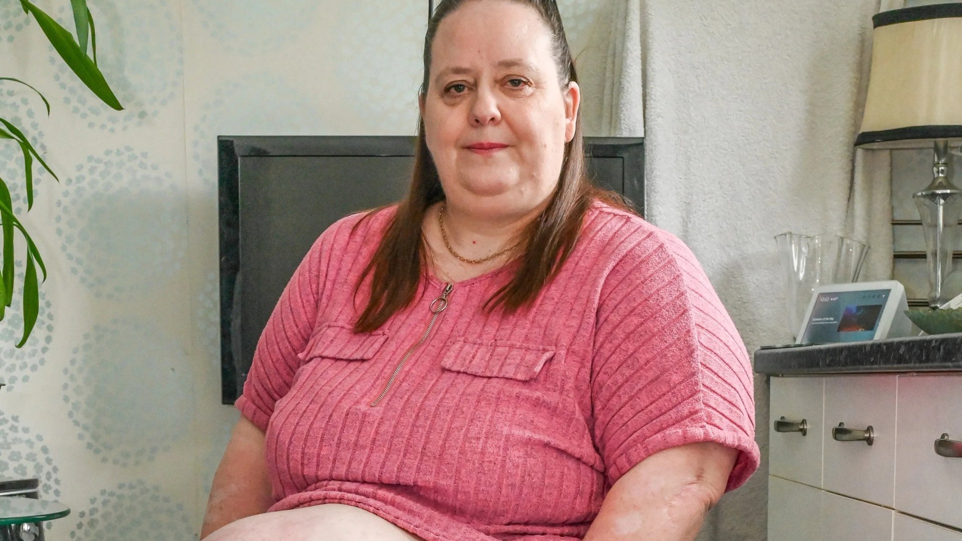 This enormous hernia has been growing for 18 years & trapped me in my home… but now my nightmare may finally be over