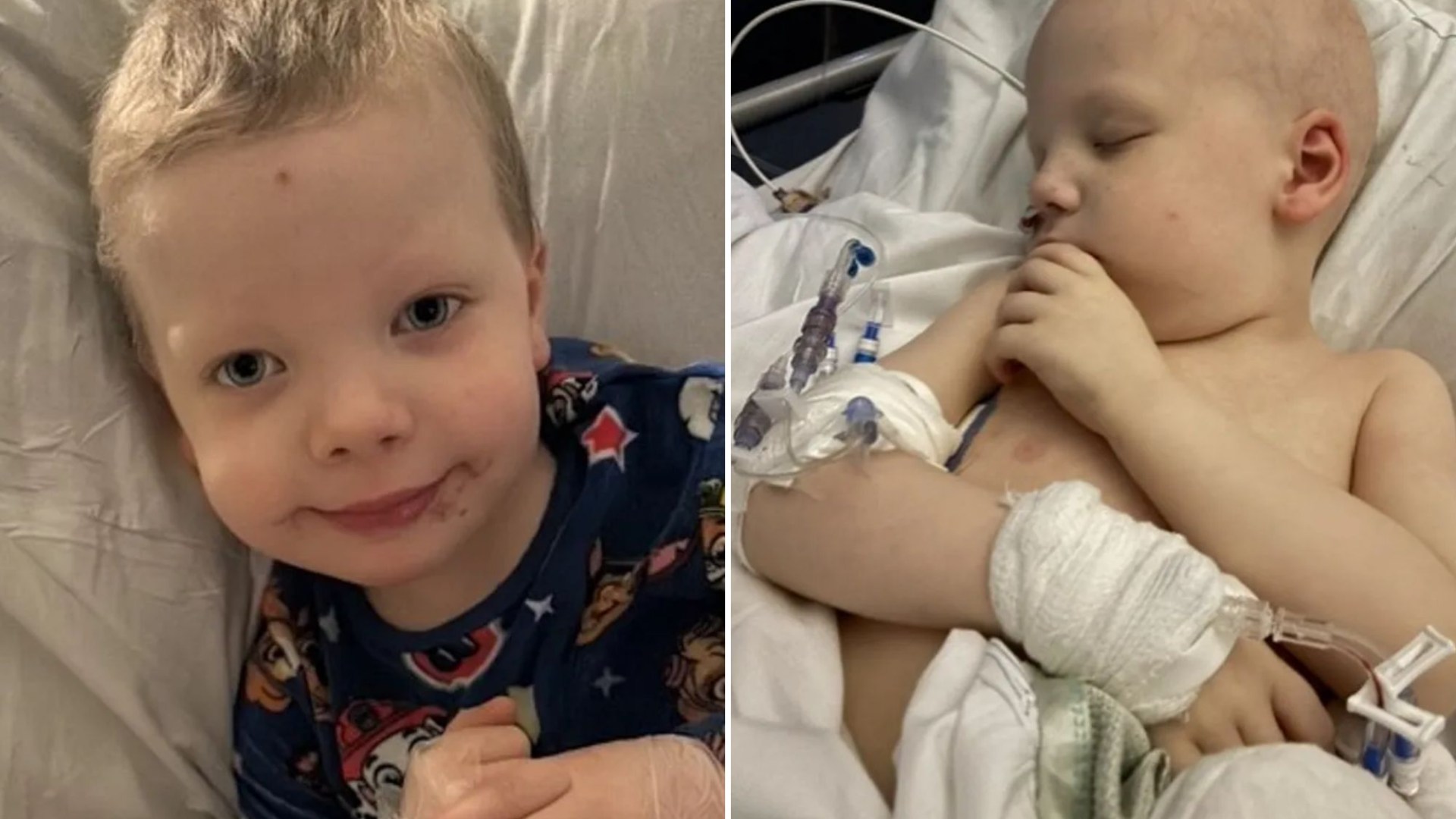 Toddler, 3, went blind from brain cancer after being sent home from A&E with Calpol when nursery spotted worrying sign