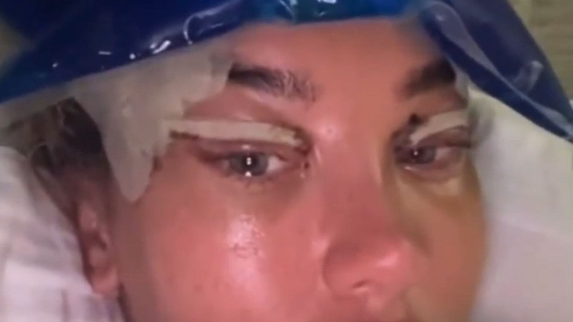 Towie’s Dani Imbert struggles to blink after gory new surgery as fans fear she’s going too far