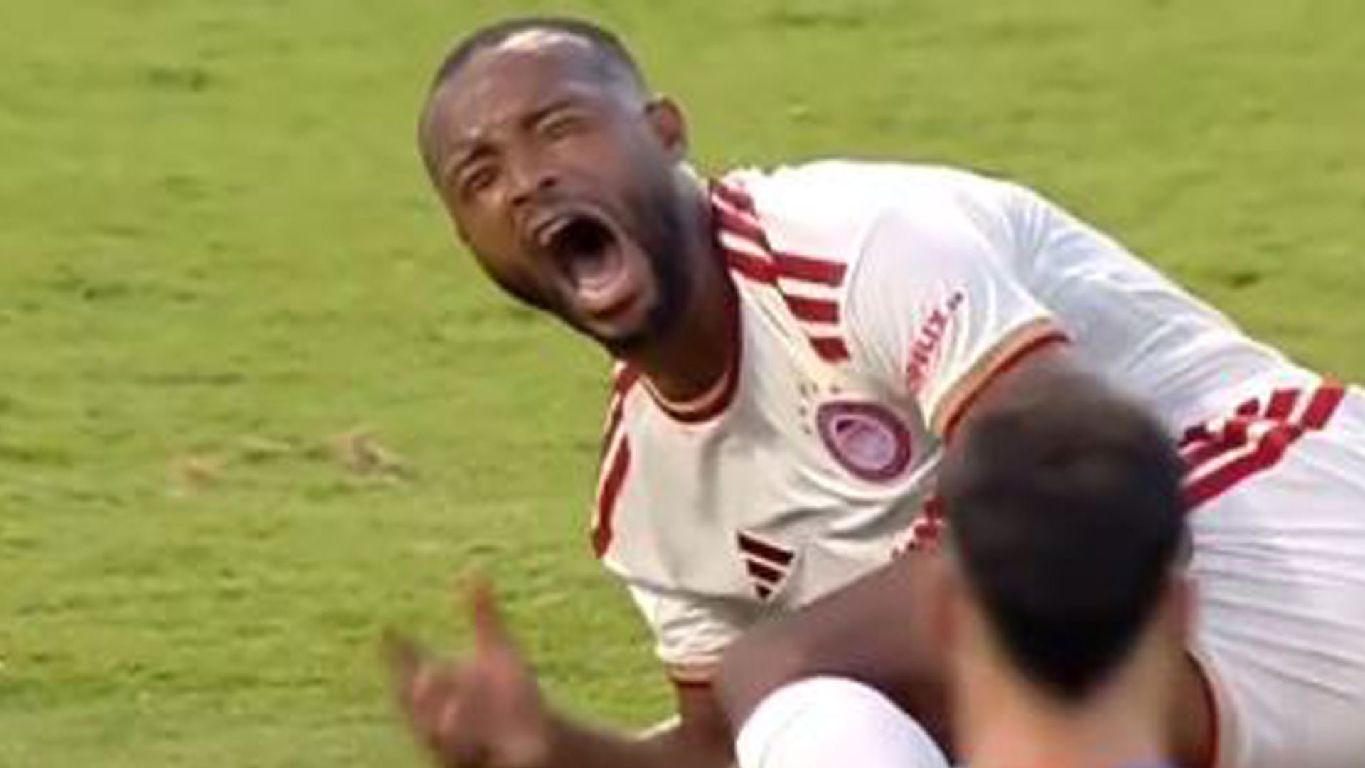 World Cup star rushed to hospital with broken leg so horrific it leaves rival keeper in tears