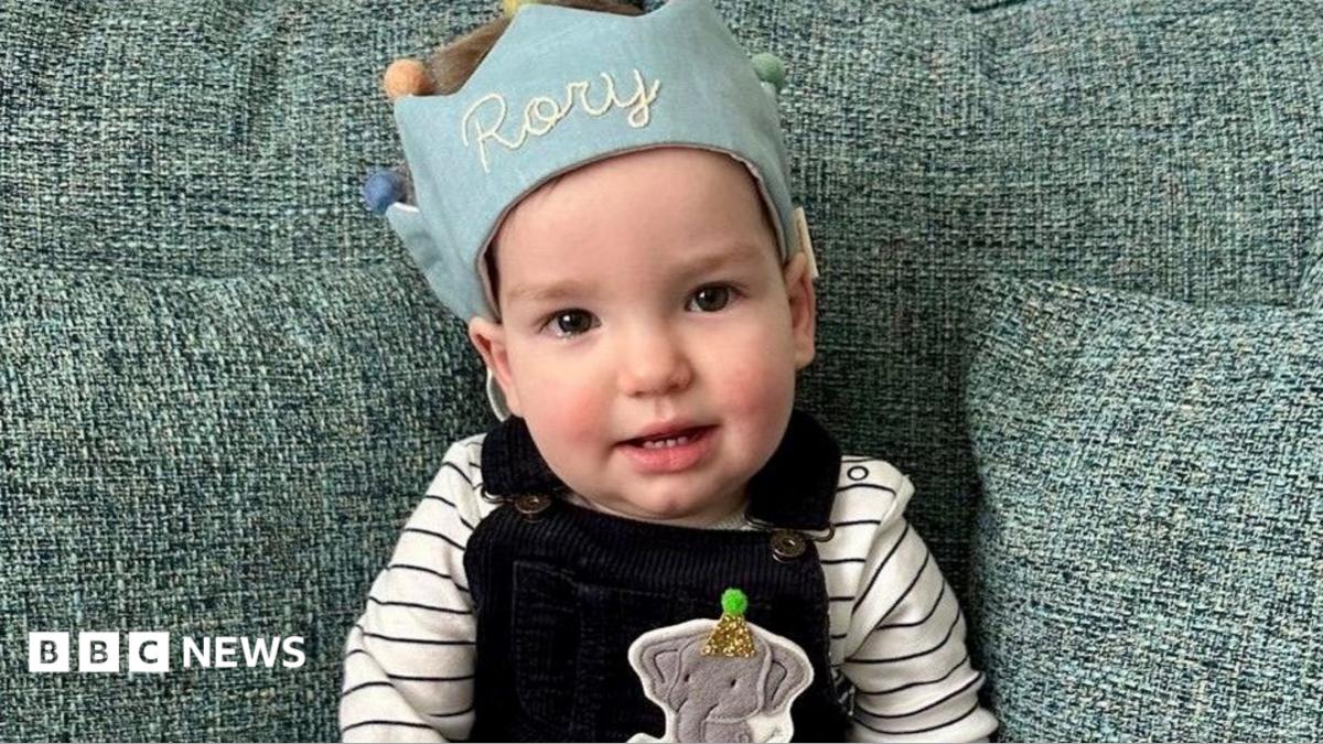 World-first surgery for baby's rare skull condition