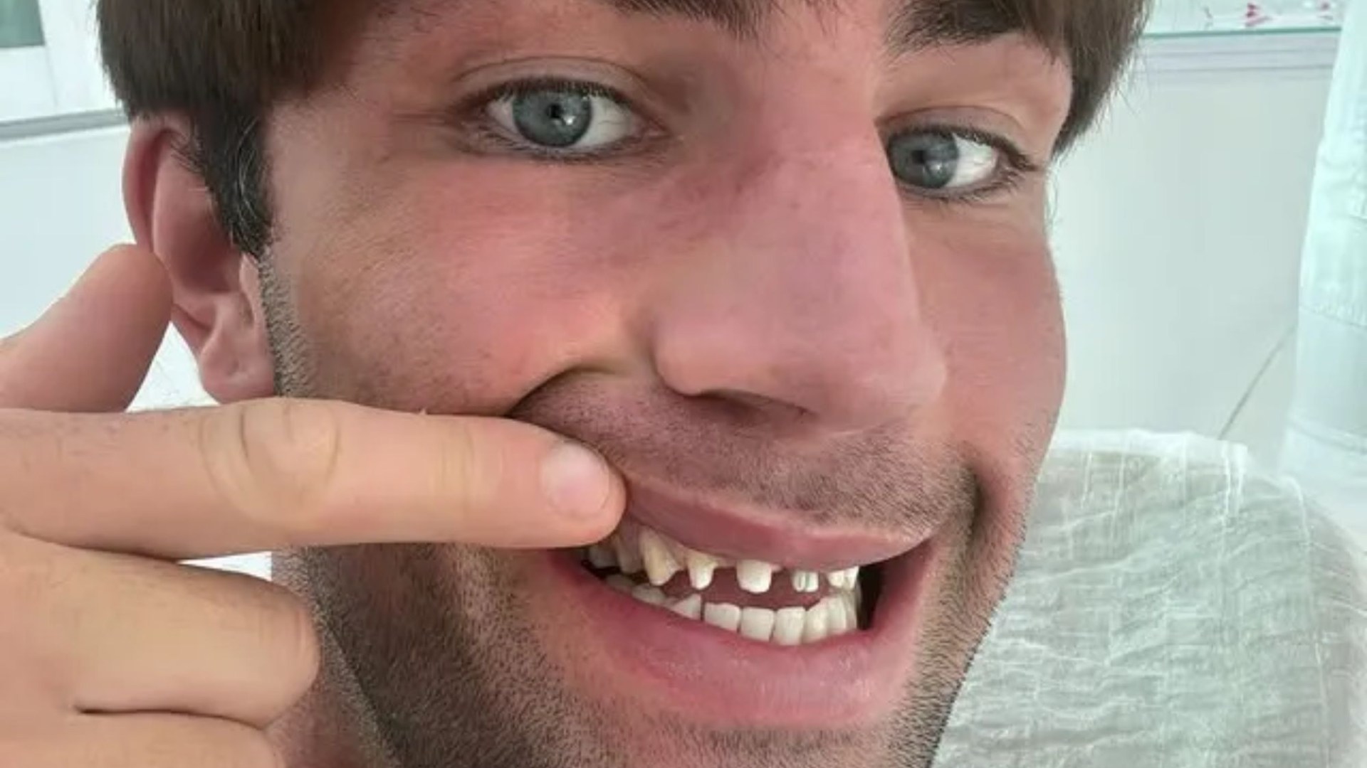 ‘Brown pegs’, gnashers you can see from space & REAL smile you’ll never unsee – the most dramatic celeb teeth makeovers